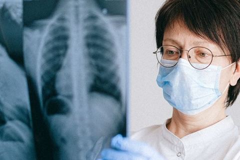 Miniature de Des particules de plastique retrouvées dans les poumons de personnes vivantes